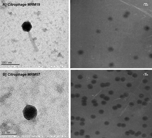 bacteriophage